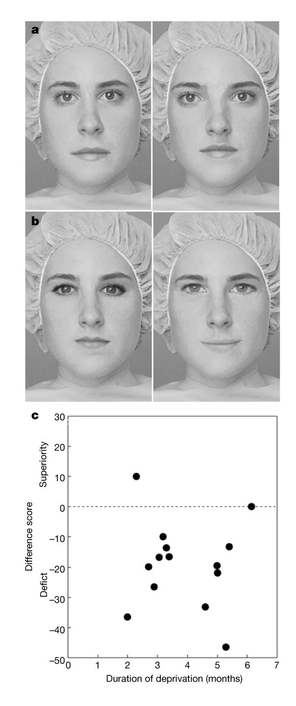 https://media.springernature.com/full/springer-static/image/art%3A10.1038%2F35073749/MediaObjects/41586_2001_Article_BF35073749_Fig1_HTML.jpg?as=webp